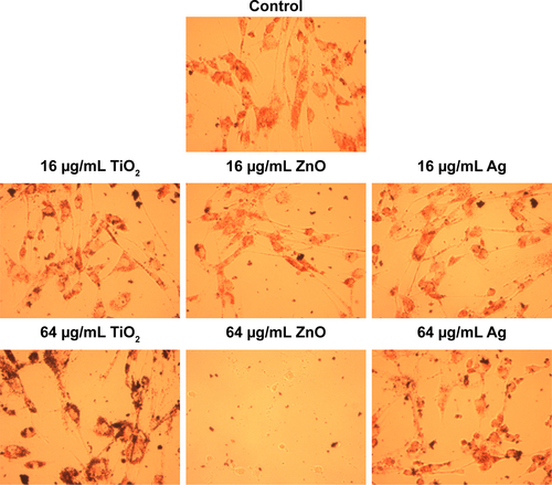 Figure S4 Representative images showing neutral red staining of HASMCs after NP exposure.Notes: HASMCs were exposed to 0 µg/mL (control), 16 µg/mL, and 64 µg/mL TiO2, ZnO, or Ag NPs for 24 hours, and then stained with neutral red. Images taken under light microscopy (magnification 200×).Abbreviations: HASMCs, human aortic smooth-muscle cells; NPs, nanoparticles.
