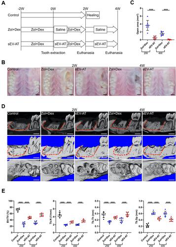 Figure 3 Effects of sEV-AT injection on rat BRONJ model. (A) Development of rat BRONJ model and schedule of sEV-AT injection (Control: natural healing group; Zol+Dex: Zol+Dex and saline treated group; sEV-AT: Zol+Dex and sEV-AT treated group). (B) Representative intraoral photos. Scale bar=1mm. (C) Open area without epithelium coverage. Open area was significantly decreased by sEV-AT treatment (***p<0.001). (D) Representative μCT images of tooth extraction sockets (red dotted lines: tooth extraction sockets). Scale bar=1mm. (E) Quantification of BV/TV, Tb.N, Tb.Th and Tb.Sp in each group (***p<0.001).