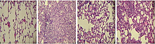 Figure 2. Hematoxylin-eosin staining of the lung tissues sections. (A) Sections of the group receiving PBS (negative control), which shows normal lung tissues. (B) Sections of the group receiving bleomycin (positive control): a reduction in alveolar space and an increase in the accumulation of connective tissue can be seen. (C) Sections of the group receiving aqueous extract of licorice for 20 days after the administration of bleomycin. In this group, the alveolar space increased and the connective tissue decreased compared to the positive control. (D) The group receiving hydroalcoholic extract of licorice for 20 days following bleomycin instillation had no significant changes compared to the bleomycin group (the positive control). Magnification 400×.
