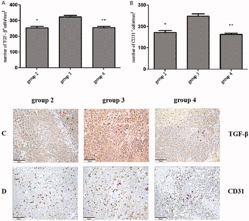 Figure 6. The expression of transforming growth factor-beta and cluster of differentiation 31 in tumours. (A) The number of transforming growth factor beta+ (TGF-β+) cells per square millimetre. (B) The number of CD31+ cells per square millimetre. (C) The immunohistochemical staining (HIC) for TGF-β+ cells in tumour tissue in each group. (D) The HIC staining for the cluster of differentiation (CD) 31+ cells in tumour tissue in each group. Scale bars, 50 µm. *P < .01 group 2 vs. group 3; **P < .01 group 3 vs. group 4. The HIC staining for cells with the nuclear deposition of violet pigment was positive (black arrow) and the nuclear deposition of blue pigment was negative (red arrow) (original magnification x200). Values are shown as the means ± the standard deviation. Group 1 is the mock group; group 2 is the implantation without ALPPS group; group 3 is the implantation/ALPPS group; group 4 is the implantation/ALPPS/CA group.