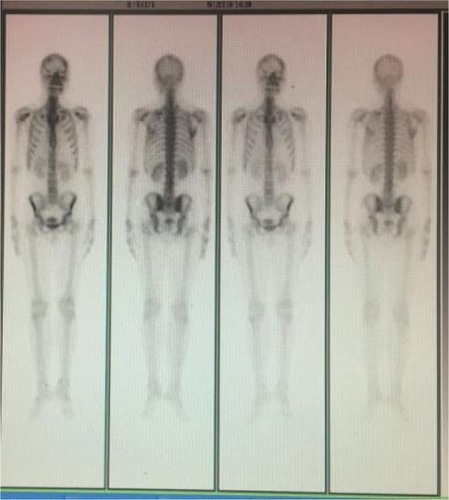 Figure 7 Radiological bone imaging.