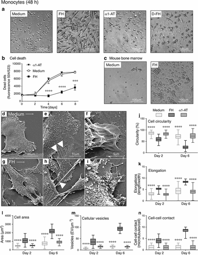 Figure 1. FH changes the morphology and prolongs the viability of monocytes