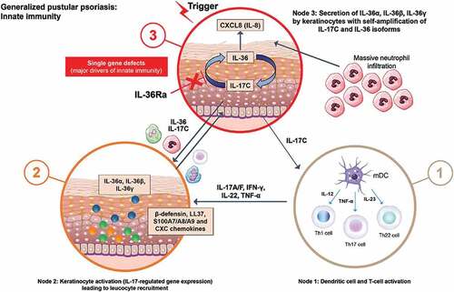 Figure 2. Immuno-pathogenesis of generalized pustular psoriasis. Self-amplification of IL-36 and IL-17C in the absence of functional IL-36Ra leads to very high levels of CXCL8 (IL-8) and other CXCL chemokines that produce massive neutrophil influx. CXCL, C-X-C motif chemokine ligand; GPP, generalized pustular psoriasis; IL, interleukin; R, receptor. (adapted from [Citation1]).