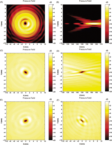 Figure 3. Pressure field of an anti-focus located at (0, 0, 150). (A) and (B) are the x-y and y-z plane field, respectively, obtained from M-order complex root of 1. (A) and (B) show that the zero pressure point is achieved by systematic shifting of the focus point. (C) and (D) are x-y and y-z plane field, respectively, obtained using ODRPI with the first element as the basis. (E) and (F) are x-y plane fields obtained using ODRPI with the 10th and the 513th element as the basis, respectively. (C) to (F) show the anti-focus with ODRPI is not a systematic shift of a focus. Additionally, the choice of the base element determines the overall shape of the field around the anti-focus point.