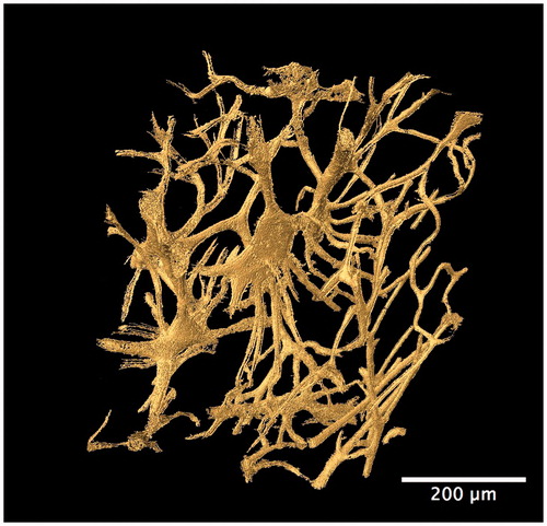 Figure 5. Synchrotron radiation-based micro-CT 3D render of the cortical bone vascular canal network from a human temporal bone specimen (gold). A high degree of interconnectivity among the entire vascular network is evident. Scale = 200 μm. Credit: JM Andronowski. Reprint permission granted by the publisher. (For interpretation of the references to colour in this figure legend, the reader is referred to the web version of the article).