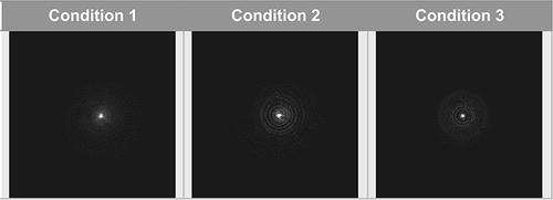 Figure 6 The visualization of the low-intensity light distribution produced by a 0.1-mm pinhole was recorded through a 4.5-mm pupil. Condition 1 = +0.27-µm SA cornea and polychromatic light; Condition 2 = +0.27-µm SA cornea and monochromatic light; Condition 3 = SA-neutral cornea and monochromatic light.