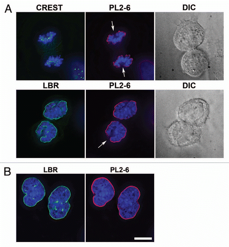 Figure 5 Nuclear and chromosomal regions that demonstrate an absence of epichromatin staining. (A) presents telophase U2OS cells with discernable chromosome “core” regions. The left column of images pairs anti-centrosome CREST (top row) or anti-LBR (second row) with DAPI. The middle column of images pairs PL2-6 with DAPI. The right column presents a differential interference contrast (DIC) image of the separating daughter cells in the same field. Arrows point to mitotic chromosome “cores”. (B) displays interphase U2OS nuclei with intranuclear tubules. The left image pairs anti-LBR with DAPI. The right image pairs PL2-6 with DAPI. Intranuclear tubules are clearly stained by anti-LBR, but not by PL2-6. Bar equals 10 µm.