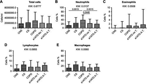 Figure 1 Total inflammatory cells (cells/ml) (A), and percentages of neutrophils (B), eosinophils (C), lymphocytes (D) and macrophages (E) in cytospin preparations from control non-smokers (CON, n=21), control smokers (CS, n=20), cigarette smoke-associated COPD (n=20), α1-anti trypsin deficiency not in therapy (AATD-noT, n=21) and AATD patients on augmentation therapy (AATD-AT, n=20). The total number of inflammatory cells, and the percentage of eosinophils, macrophages and lymphocytes did not differ (K. Wallis: p=0.6777, p=0.0508 and p=0.0560, p=0.0955, respectively) in the five groups studied. The percentage of neutrophils (K. Wallis: p=0.0137) was significantly higher in cigarette smoke-associated COPD compared to CNS (p=0.0015) and AATD-AT (p=0.0135) (B). Cigarette smoke-associated COPD also differed from AATD-NoT (p=0.0446). Data are presented as median and interquartile range. Statistical analysis between groups: Mann-Whitney U test, reported only when the Kruskal-Wallis (KW) test resulted significant.