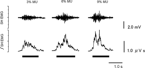 Figure 1.  Sample data of suprahyoid muscle activity during the swallowing of the three test foods. The two traces depict electromyograms recorded from the suprahyoid muscles (∫SH EMG) and their integration (∫SH EMG) during the swallowing of the three test foods. The thick horizontal lines under ∫SH EMG indicate the periods from the start to the end of swallowing.