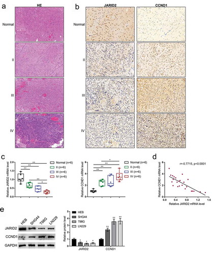 Figure 1. Expression and correlation of JARID2 and CCND1 in tissue samples and cell lines. (a) Eighteen glioma tissue samples (six cases of WHO grade II, III, and IV, respectively) and six samples from the peritumoral brain edema (PTBE) region were obtained and examined for the histopathological features by H&E staining. (b) JARID2 and CCND1 contents in tissue samples were examined by IHC staining. (c) The mRNA expression levels of JARID2 and CCND1 contents in tissue samples were examined by qRT-PCR. (d) The correlation between JARID2 and CCND1 expression was analyzed using Pearson’s correlation analysis. (e) The protein levels of JARID2 and CCND1 were determined in a normal glial cell line HEB and three glioma cell lines, SHG44, T98G, and LN229 by immunoblotting. *P < 0.05, **P < 0.01