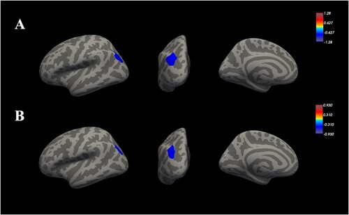 Figure 1. Distribution maps of group differences in surface area. (A): The blue regions represent smaller surface area of the left hemisphere in the SDNP group than in the HC group at baseline. (B): The blue regions represent smaller surface area of the left hemisphere in the SDNP group than in the HC group at follow-up. The color scale is represented as −log P. SDNP: Shidu parents without any psychiatric disorders; HC: healthy controls.