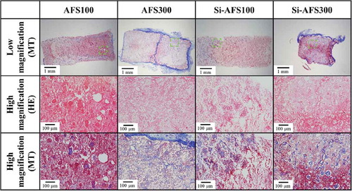 Figure 9. HE and MT staining of specimens removed from fat (decalcified section). High magnification: highly magnified images of dashed square areas. HE staining: nucleus: blue; cell membrane: red. MT staining: muscle fiber: red; collagen fiber: violet.