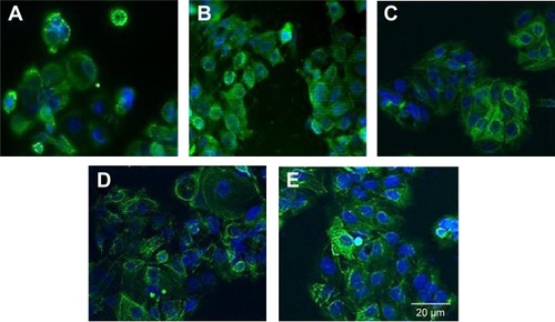 Figure 11 Effects of Bioimprint on expression of cytokeratin-18.Notes: Immunofluorescence staining of cytokeratin-18 in cells cultured on (A) (f)pMA and (B) (−)pMA imprint; and on (C) (f)pST, (D) (−)pST, and (E) (+)pST imprints. Cells grown on different surfaces were fixed with 4% paraformaldehyde and permeabilized using cold methanol; then cytokeratin-18 was probed using mouse anti-cytokeratin-18 that was labeled with AlexaFluor 488 (green). Cell nuclei were co-stained with Hoechst 33342 (blue) (original magnifications: ×20).Abbreviations: (−), negative imprint; (+), positive imprint; (f), flat substrate; pMA, polymethacrylate; pST, polystyrene.