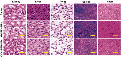 Figure 6. H&E staining of the major organs (kidney, liver, lung, spleen and heart) excised from different treatment mice groups. Scale bar: 100 μm.