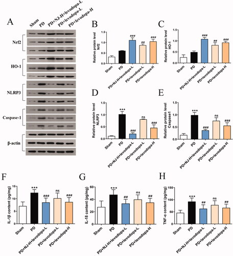 Figure 7. NJ combined with levodopa alleviated oxidative stress and neuroinflammation by activating the Nrf2 signaling pathway and inhibiting the NLRP3 signaling pathway. (A) the contents of Nrf2, HO-1, NLRP3 and caspase-1 in the ST of rats were detected by Western blot analysis. (B-E) Densitometry of the Western blot results (n = 3 per group). (F-H) quantitative analysis of IL-1β, IL-18, TNF-α levels in the ST of rats by ELISA (n = 8 per group). Data are expressed as the mean ± SD. ***p < 0.001 compared with sham group; ##p < 0.01, ###p < 0.001 compared with PD group; ns, p > 0.05, compared with PD group.