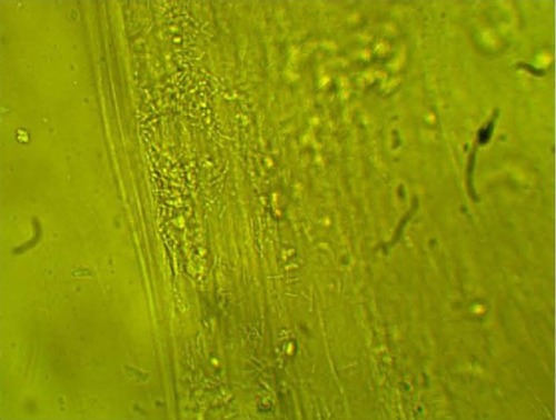 Figure 7 Clumping of lactobacilli: matrix formation with biofilm appearance.