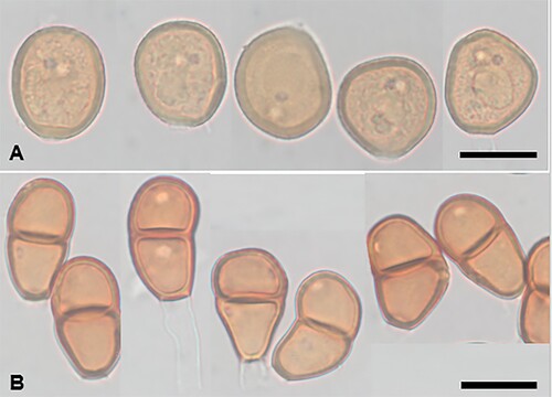 Figure 18. Puccinia microseridicola on Microseris scapigera. A, Urediniospores. B, Teliospores. Scale bars = 20 μm.