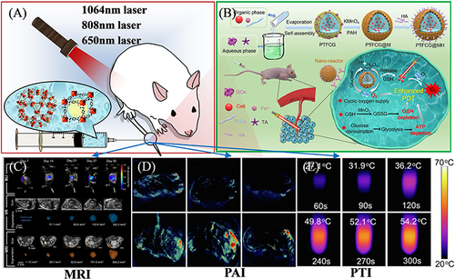 Figure 11 (A) Schematic illustration of imaging-guided therapy. (B) Photodynamic tumor therapy (PDT) by reversing multiple resistances. Reprinted from Liu P, Zhou Y, Shi X, et al. A cyclic nano-reactor achieving enhanced photodynamic tumor therapy by reversing multiple resistances. J Nanobiotechnol. 2021;19:149. Creative Commons.Citation138 (C) MRI imaging of orthotopic pancreatic murine tumors. Reprinted from Rojas JD, Joiner JB, Velasco B, et al. Validation of a combined ultrasound and bioluminescence imaging system with magnetic resonance imaging in orthotopic pancreatic murine tumors. Sci Rep. 2022;12:102. Creative Commons.Citation130 (D) PAI images and (E) Photothermal photographs of doxorubicin@MIL-100 compound. Reprinted from Zhiming H, Caina X, Liang Y, et al. Multifunctional drug delivery nanoparticles based on MIL-100 (Fe) for photoacoustic imaging-guided synergistic chemodynamic/chemo/photothermal breast cancer therapy. Mater Design. 2022;223:111132. Creative Commons..Citation131