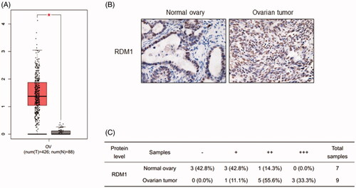 Figure 1. RDM1 is up-regulated in human ovarian carcinoma tumours. (A) The RDM1 gene expression information from ovarian cancer patients in The Cancer Genome Atlas (TCGA). T: ovarian tumour tissue, n = 426; N: normal ovarian tissue, n = 88. Data are expressed as mean ± SD. *p < .05. (B) Representative Immunohistochemistry (IHC) images of RDM1 in normal and ovarian tumour tissues of human patients. (C) Summary and statistical analysis of experiments in (B) with human normal ovary (n = 7) and ovarian tumour tissues (n = 9). Scale bar, 25 μm (magnification, ×40).