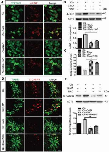 Figure 6. Antioxidant treatment successfully rescued the increased SGN loss induced by autophagy inhibition after cisplatin injury. The cultured middle turn cochleae were treated with cisplatin (50 μM) alone, cotreated with NAC (2 mM), or pretreated with 3-MA (5 mM) for 6 h then cotreated with NAC for 48 h. (A and B) Immunofluorescence signals (A) and the protein expression levels (B) of 4-HNE were lower in the Cis + NAC group compared to the cisplatin-only group, and they were also reduced in the Cis + 3-MA + NAC group compared to the Cis + 3-MA group. Scale bars: 12.5 μm. (C-E) The NAC treatment significantly increased the number of surviving SGNs (C) and decreased the expression of cleaved-CASP3 (D and E) in the Cis + NAC group compared to the cisplatin-only group, as well as in Cis + 3-MA + NAC group versus the Cis + 3-MA group. Scale bars: 25 μm. n = 6 for each subgroup. All data are presented as the mean ± SEM, * P < 0.05, ** P < 0.01