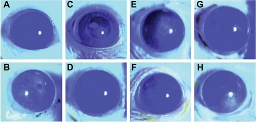 Figure 2 Trehalose protects against corneal damage due to desiccation. Corneal fluorescein staining following exposure to a desiccant environment. Mice were exposed to a desiccating environment for 21 days and then received treatment with phosphate-buffered saline, trehalose eyedrops, or mouse serum eyedrops for 14 days. A) Control mice, B) 21 days desiccation without treatments, C) and D) seven and 14 days’ desiccation with trehalose treatment, E) and F) seven and 14 days desiccation’ with mouse serum treatment, G) and H) seven and 14 days’ desiccation with phosphate-buffered saline treatment.Copyright© 2010. Elsevier. Reproduced with permission from Chen W, Zhang X, Liu M, et al. Trehalose protects against ocular surface disorders in experimental murine dry eye through suppression of apoptosis. Exp Eye Res. 2009;89: 311–318.Citation23