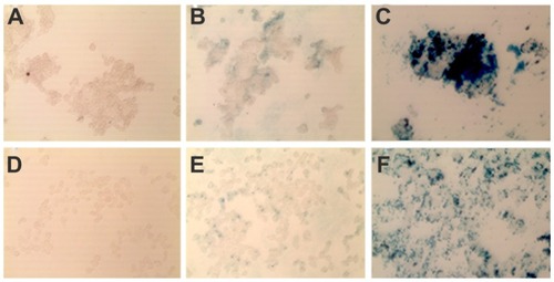 Figure 5 In vitro specificity of MF-anti-CEA by Prussian blue iron staining. LS174T (A–C) and HCT116 (D–F) cells were cultivated for 5 hours with MF (B and E), and MF-anti-CEA (C and F) at same iron concentration (60 ng/μL). Untreated cells (A and D) were negative control.Abbreviations: MF, magnetic fluid; CEA, carcinoembryonic antigen.