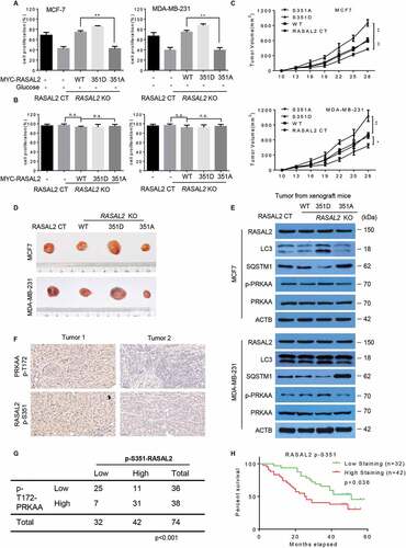 Figure 6. RASAL2 S351 phosphorylation promotes breast cancer growth and indicates a poor prognosis in breast cancer patients. (A and B) RASAL2-CT or RASAL2-KO MCF7 and MDA-MB-231 cells with reconstituted expression of MYC-RASAL2 WT, MYC-RASAL2351D and MYC-RASAL2351A were cultured in the present (A) or absent (B) of glucose-deprived medium for 24 h, and cell viability was determined by MTT assays. Results are reported as means ± SEM of three replicates. **p < 0.01, N.S., not significant. (C – E) RASAL2-CT and RASAL2-KO MCF7 or MDA-MB-231 cells stably expressing MYC-RASAL2 (WT, S351D, S351A) were subcutaneously injected into nude mice (n = 5/group). (C) Tumor volumes were calculated, and (D) representative tumors were photographed. (E) Tumor tissues in (C) were used for immunoblotting as indicated. Data represent the mean ± SEM of five mice. *p < 0.05, **p < 0.01. (F and G) IHC staining of breast tissue microarray (TMA) with antibody against RASAL2 S351 phosphorylationand PRKAA-T172 phosphorylation were performed. Brown staining indicates positive immune reactivity. Chi-squareanalysis was performed depending on the staining scores. (H) Kaplan-Meier curves showing the overall survival rates of breast cancer patients with high or low expression of p-S351-RASAL2. Statistical significance was calculated by using a log-rank test