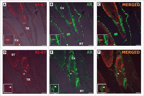 Figure 8. Double-label immunofluorescence for Ki-67 (A, D) and AR (B, E) in adult Wistar rats. As it can be noted, AR positive Sertoli cells are Ki-67 negative (orange arrow C, F), while Ki-67 positive Sertoli cells are AR negative (white arrowhead C, F). Rete testis epithelial cells were also observed expressing Ki-67 and AR (RT blue arrow C). TR: transition region; Cx: area adjacent to the TR; ST: seminiferous tubules. Bar: 50 μm.