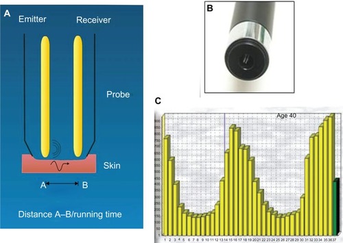 Figure 4 Reviscometer® RVM 600.Notes: (A) Mechanism: two sensors are applied on the skin surface. One sensor is emitting the acoustic wave A; the other is the receiver B. The software measures the propagation velocity of acoustic shockwaves. (B) Scaled head positioned in 0–180°, 45–225°, 90–270°, and 135–315°-axis, fixed with a double sided adhesive ring. (C) The software calculates the mean value of the RRT (resonance running time) parameter over 4 axes. Reviscometer® RVM 600; Courage and Khazaka, Cologne, Germany.