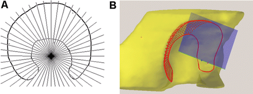 Figure 2. The oblique slicing method for segmenting the acetabulum lunate. A) Reformatting CT slices are acquired circumferentially about the medial-lateral joint line. This allows the lunate to be traced using the two intersections (medial, lateral) on each slice. B) The creation of the parametric surface implements an oblique plane (blue) rotated about the medial-lateral axis of the joint to find and interpolate points. The acetabulum of this right hip is viewed from the posterior-lateral direction. [Color version available online.]
