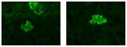 Figure 1 Representative picture of IgG staining in the glomerulus at D14. Renal deposition of anti-GBM antibodies between PPAR-γ+/+ (right) and PPAR-γ−/− mice (left).Abbreviations: GBM, glomerular basement membrane; PPAR-γ, peroxisome proliferator-activated receptor gamma.