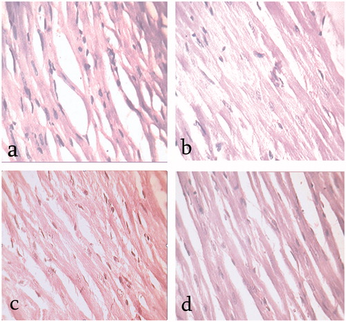 Figure 2. Haematoxylin–eosin (H & E) staining of cardiac sections of (a) control; (b) diabetic control; (c) siabetic treated with 200 mg kg−1 of EEFSB; (d) diabetic treated with 400 mg kg−1 of EEFSB. The images were taken under ×400 magnification.