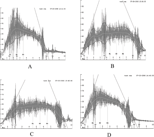 Figure 1 Mixograms of whole wheat flour treated by different heat treatment methods as well as control. A): Control (without heat treated); B): Dipped in boiling water for 30 min; C): Inpack heating under pressure at 0.352 kg/cm2 for 10 min; and D): Microwave heat treatment for 80 s.