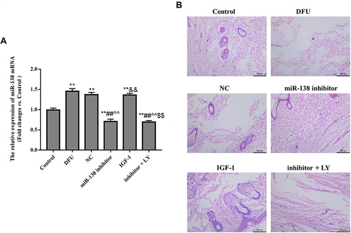 Figure 1 Effect of miR-138 on the histological changes of skin ulcer model in rats. (A) The expression of miR-138 mRNA in different groups. (B) The morphological changes of foot ulceration in different groups (×200). **p < 0.01 against Control group; ##p < 0.01 against DFU group; ^^p < 0.01 against NC group; &&p < 0.01 against miR-138 inhibitor group; $$p < 0.01 against IGF-1 group.