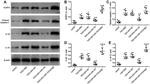 Figure 7 MiR-143 regulates inflammation and apoptosis in thyroid-associated ophthalmopathy (TAO) in vivo. (A) Levels of NLRP3, cleaved caspase-1, IL-1B, and IL-18 protein in mouse orbital tissue were analyzed by Western blot. (B–E) Each protein was normalized to β-actin. *P < 0.05, **P < 0.01, ***P < 0.001 compared to the control group. #P < 0.05 compared to the TAO+PBS group.