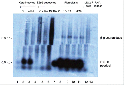 Figure 2. Northern blot detection of RIS-1/psoriasin mRNA levels. Lanes 1–3, primary human keratinocytes; lanes 4–6, human immortalized SZ95 sebocytes; lanes 7–11, primary human fibroblasts, lane 12, human prostatic carcinoma LNCaP cell line; lane 13, RNA mass ladder. DMSO control (C; lanes 1, 4, 7, 13), all-trans retinoic acid in DMSO (atRA, 10−7 M; lanes 2, 3, 5, 6, 10, 11), 13cis-retinoic acid in DMSO (13cRA, 10−7 M; lanes 8, 9).