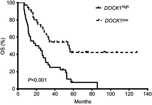 Figure 1 Kaplan–Meier curves of overall survival (OS). Patients in DOCK1high group have shorter OS than those in DOCK1low group.