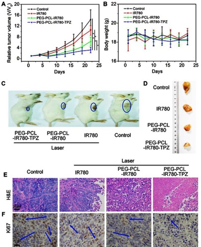 Figure 7 (A) Tumor volume growth curves of 4T1-tumor-bearing mice subjected to various treatments (*p<0.05, **p<0.01, n=6). (B) Mice weight of 4T1-tumor-bearing mice subjected to various treatments. (C) Representative images of 4T1-tumor-bearing mice subjected to various treatments. (D) Representative images of tumor tissues separated from 4T1-tumor-bearing mice subjected to various treatments. (E) Hematoxylin-eosin (H&E) staining for tumor tissue slices of different groups. (F) Ki67 staining for tumor tissue slices of different groups. Blue arrows indicate the positive expression of proliferation marker Ki67.Abbreviations: PEG-PCL-IR780-TPZ NPs, polyethylene glycol-polycaprolactone-2-[2-[2-Chloro-3-[(1,3-dihydro-3,3-dimethyl-1-propyl-2H-indol-2-ylidene)ethylidene]-1-cycloxen-1-yl]-ethenyl]-3,3-dimethy-1-propyl-1H-indolium iodide-tirapazamine nanoparticles.