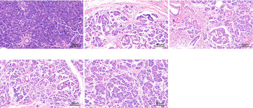 Figure 1 The PC model establishment was successful as assessed by HE staining.