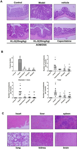 Figure 2 Effect of HLJ2 on pathology and tumor burden of AOM/DSS-induced CAC mouse mode. (A) Effect of HLJ2 on pathological damage and of colon tissue on AOM/DSS-induced CAC mouse model (100×). HLJ2 improved the pathological damage induced by AOM/DSS according to the histological assay. (B) HLJ2 (25 and 50 mg/kg) significantly reduced tumor burden, size and number of colorectal neoplasms. (C) Effect of HLJ2 on the heart, liver, spleen, lung, kidney, and brain in the vehicle group (100x). HLJ2 had no toxic effects on the heart, liver, spleen, lung, kidney, and brain. **P < 0.01 compared with control group; #P < 0.05, ##P < 0.01 compared with AOM/DSS group. Mean values ± SEM are shown (n=10).
