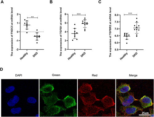 Figure 2 Irisin may be involved in the progression of DKD through TGFBR2. (A) Expression of FNDC5 gene at mRNA level. (B) Expression of TGF-β1 gene at mRNA level. (C) Expression of TGFBR2 gene at mRNA level. (D) Red fluorescent-labeled TGFBR2 and green fluorescent-labeled irisin co-localized on the cell membrane of HK-2 cells grown in high glucose. Values are expressed as mean ± SD. **p < 0.01 vs healthy group, ***p < 0.001 vs healthy group.