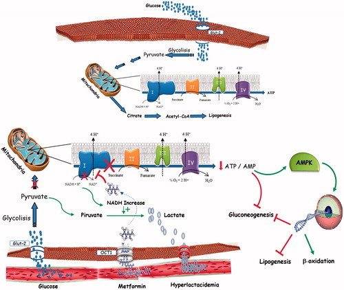 Figure 1. Lactate metabolism in physiological condition and in MALA patients.MALA may be attributed to mitochondrial impairment and subsequent generation of lactate, which finally effluxes into the circulation rather than being oxidized further.Metformin raises lactic acid levels by affecting the redox potential and promoting anaerobic metabolism, leading to a decrease in the ATP:ADP ratio and an increase in the NADH:NAD ratio. This can result in an accumulation of pyruvate (by inhibition of pyruvate dehydrogenase) that is later converted into lactate.