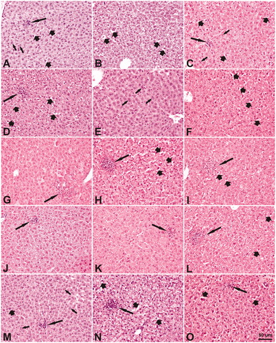 Figure 11. Microscopic changes in the liver of mice after a single intratracheal exposure to different nanomaterials. The doses of the nanomaterials were 162 µg/mouse, except of 54 µg/mouse for Nanofil9 and the dosing volume was 50 µg/mouse. (A–C) Vehicle control 1, 3, and 28 days post-exposure; (D–F) Bentonite 1, 3, and 28 days post-exposure; (G–I) Nanofil9 1, 3, and 28 days post-exposure. (J–L) NanofilSE 3000 1, 3, and 28 days post-exposure; (M–0) carbon black 1, 3, and 28 days post-exposure. Long arrows – Focal inflammatory cell infiltrates: small on A, C, J, K, M, and O or big on D, G–I, L, and N (note adjacent necrotic hepatocytes with distinct eosinophilic cytoplasm). Thick short arrows – cytoplasmic vacuolation in hepatocytes (A–D, F, H, I, M–O). Small arrows – binucleate hepatocytes (A, C, E, M). Sinusoid dilatation – white long spaces between hepatic cords (J–M). Heamatoxylin and eosin stain, magnification as scale on the figure O.