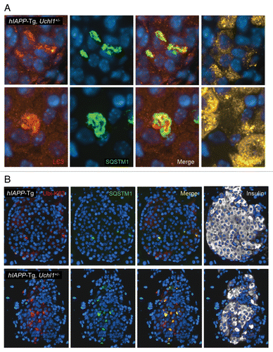 Figure 7. (A) Fluorescence confocal images of LC3 and SQSTM1 at magnification x 63 (LC3, red; SQSTM1, green; insulin, yellow; nuclei, blue) in pancreatic tissue from 7–8-wk-old hIAPP-Tg, Uchl1+/− mice. (B) The detection and localization of ubiquitin lysine 63 chains were assessed by immunofluorescence (ubiquitin K63, red; SQSTM1, green; insulin, white; nuclei, blue) in pancreatic tissue from 7–8-wk-old hIAPP-Tg mice and hIAPP-Tg, Uchl1+/− mice.