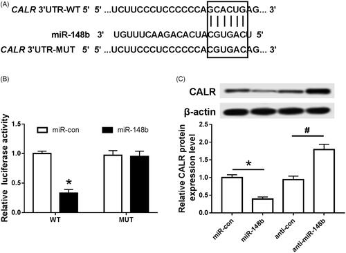 Figure 4. MiR-148b targeting CALR. (A) miR-148b targeting combined with the sequence information of the CALR mRNA 3’UTR; (B) the effect of miR-148b on the activity of Schwann cells luciferase; (C) the effect of miR-148b on the expression of CALR protein in Schwann cells; Compared with the miR-con group, *P < .05; compared with the anti-miR-con group, #P < .05.