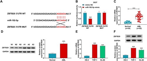 Figure 5. ZBTB20 was a direct target gene of miR-192-5p. (A) The binding sites between miR-192-5p and 3’UTR of ZBTB20 were exhibited. (B) Dual-luciferase reporter assay was implemented to prove the interaction between miR-192-5p and ZBTB20 in HEK293 T cells. (C and D) The mRNA and protein levels of ZBTB20 in AML tissues and normal tissues were determined by qRT-PCR assay or western blot assay. (E and F) The qRT-PCR and western blot assays were employed to test ZBTB20 abundance in HS-5, THP-1, and HL-60 cells. ***P < 0.001.