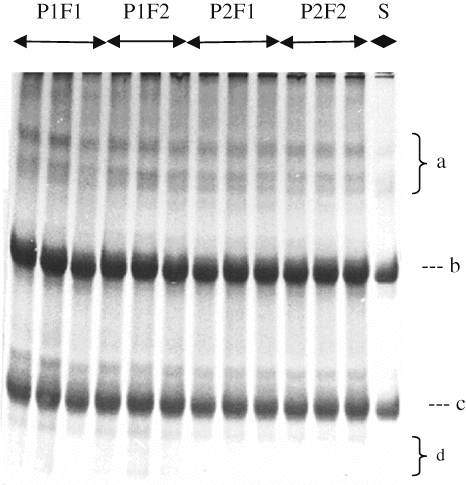 Figure 2 Urea-PAGE profiles of Herby cheeses for 90 days.