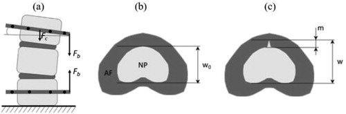 Figure 1. Measurement of the nucleus sagittal boundary displacement (w), the nucleus pulposus (NP) migration (m) within the annulus fibrosus (AF) and nucleus sagittal strain according to compression (Fc) and bending (Fb) force: (a) setup; (b) reference mechanical loading state (neutral, non-fissured disc); (c) mechanical state with partial migration of the nucleus.