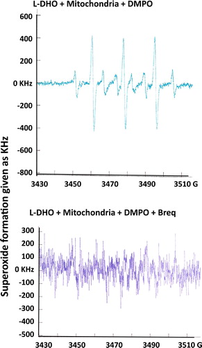 Figure 3. Superoxide formation after incubation of isolated rat liver mitochondria with 0.3 mM L-DHO for 30 min. Instrumental conditions: magnetic field, center field 3480 G; sweep width 10 G; modulation frequency, 9.78 kHz; modulation amplitude, 0.990 G; gain, 3.20 × 105; power, 50 mW; conversion time, 10.24 ms; number of scans, 20; scan time, 40 s. DMPO was used to trap superoxide which is shown in the typical spectrum in the upper figure. Inhibition of DHO-DH was achieved by addition of 1.5 μM Brequinar. One representative experiment out of 3 is shown.