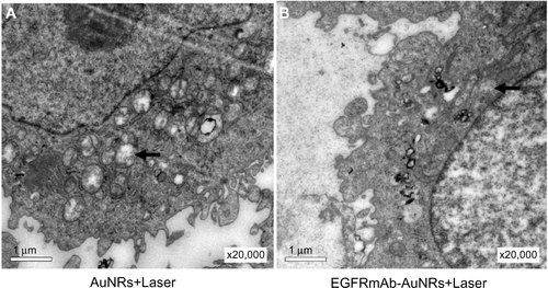 Figure S3 The autophagic structures (vacuolar components and secondary-lysosomes) in Hep-2 cells treated with (A) AuNRs+Laser, or (B) EGFRmAb-AuNRs+Laser, by TEM analysis.Note: Hep-2 cells were treated with AuNRs+Laser or EGFRmAb-AuNRs+Laser, and the irradiated cells, at 24 hours, were collected for TEM analysis.Abbreviations: AuNR, gold nanorod; EGFR, epidermal growth factor receptor; EGFRmAb, anti-EGFR monoclonal antibody; TEM, transmission electron microscope.